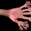 Prečo majú ľudia len päť prstov na rukách a nohách?